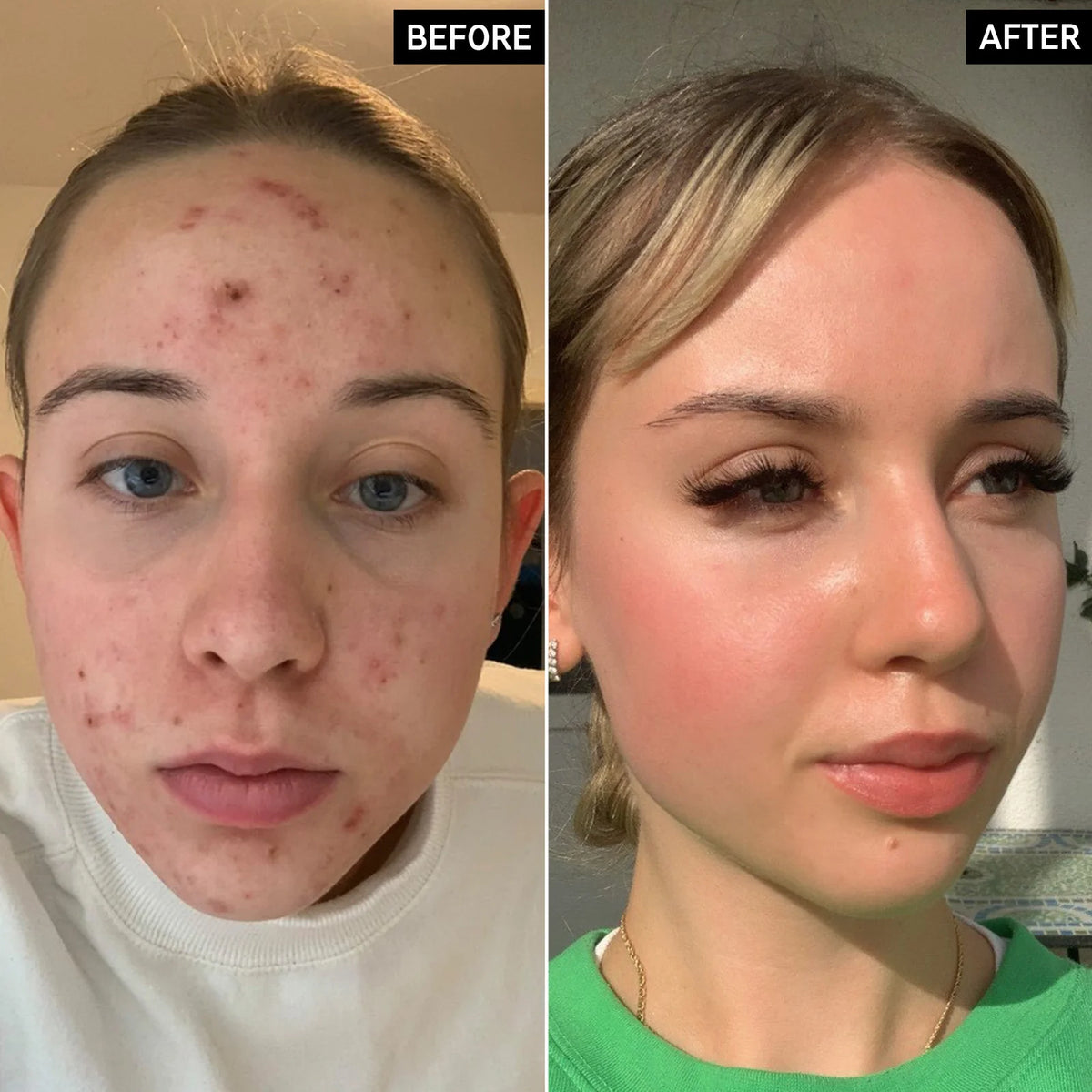 Concealer voor donkere vlekken