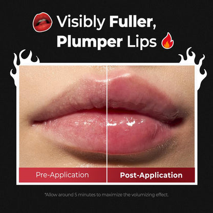 Lippenfüller